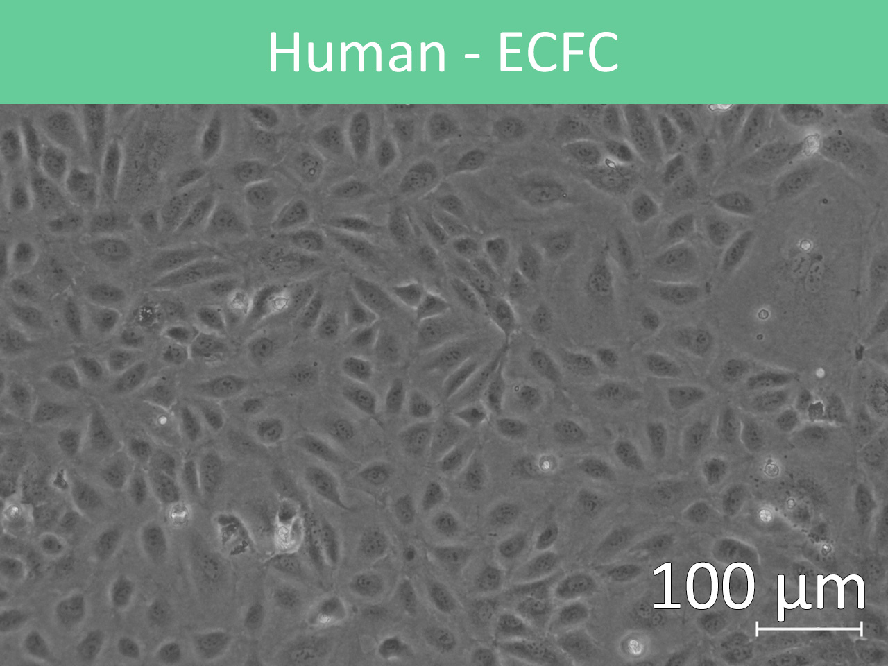 Human Cord Blood-Derived ECFCs in culture (phase contrast, 100 µm scale bar)